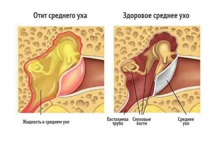 Betegségei a belső fül, a tünetek, okok, kezelés