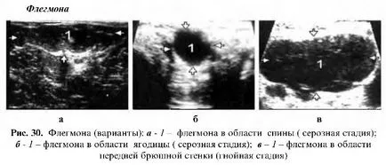 разследване на кожата с ултразвук