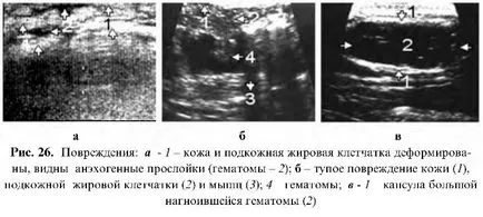 разследване на кожата с ултразвук