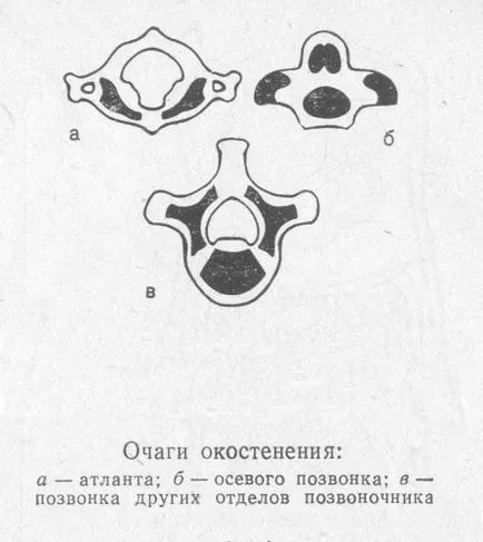 Anomaliile cauze ale coloanei vertebrale, simptome, tratament