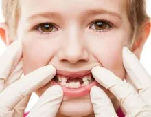 Атрофичен гингивит причинява, развитие и лечение на заболяване на венците