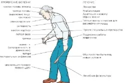 Boala Parkinson la simptome tinere și semne