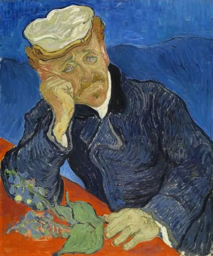 Nebunie, sifilis, istoricul medical scorbut lui Vincent Van Gogh