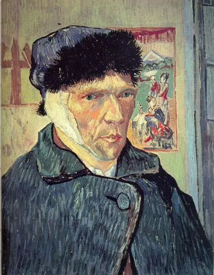 Nebunie, sifilis, istoricul medical scorbut lui Vincent Van Gogh