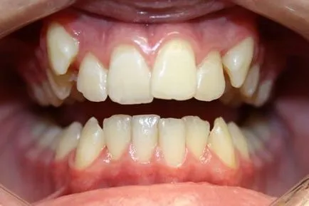 Care trateaza ortodont medicul care este, ce probleme sunt rezolvate