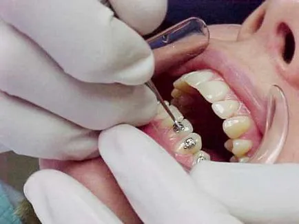 Care trateaza ortodont medicul care este, ce probleme sunt rezolvate