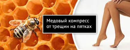 Този препарат на пукнатини по петите на крем, мехлем, компреси