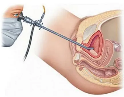 Cystoscopy се извършва и когато и двете показва как