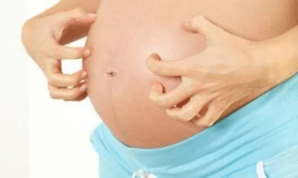 Дерматит бременни видове, симптоми и лечение