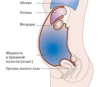 Рак Diaignostika метод Uzi прилича на чернодробен тумор на Uzi