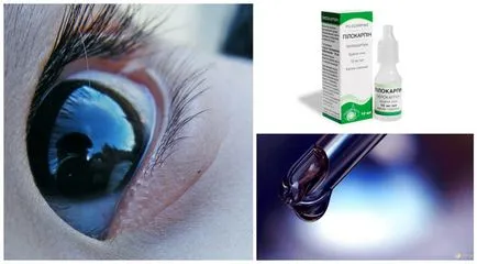 Капки за очи от глаукома и очно налягане, както и пълен списък със съвети