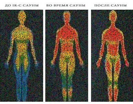 Инфрачервена сауна за отзиви за отслабване, показания, противопоказания, резултати
