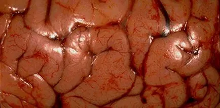 Ischemica accident vascular cerebral prognostic pentru viață, cum să mențină sănătatea