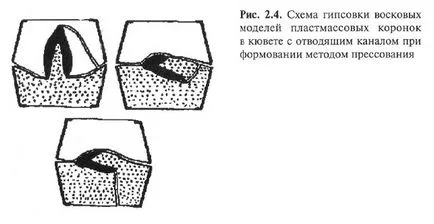 Producerea de proteze dentare fixe cu utilizarea de materiale polimerice stomlend