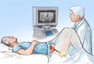 Ultrasunete a genito tipuri de sisteme, indicații, pregătirea, desfășurarea, rezultatele