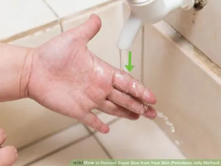 Hogyan lehet eltávolítani a szuper ragasztó az ujjak a hatékony módszerek