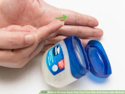Hogyan lehet eltávolítani a szuper ragasztó az ujjak a hatékony módszerek