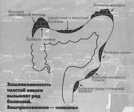 Как да се подобри чревната флора, с отслабване, красота и здраве