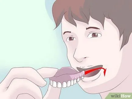 Hogyan törődik fogsor