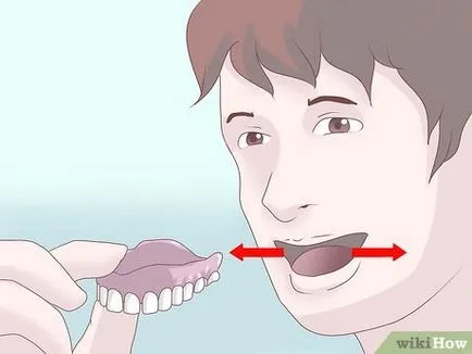Hogyan törődik fogsor