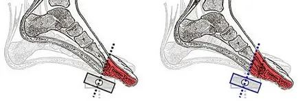 pedale de contact, setarea cepului