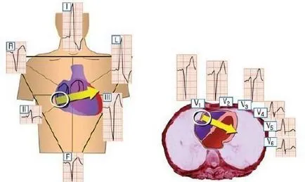 A delta-hullámok és lokalizációja további felhasználási módját EKG