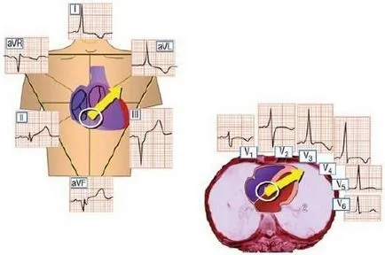 Delta вълна и локализиране на допълнителни начини за използване на електрокардиография