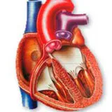 Lehetséges, hogy szülni egy szívhiba - foramen ovale, Fallot-tetralógia