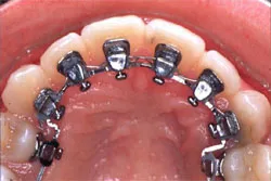 за ортодонтия