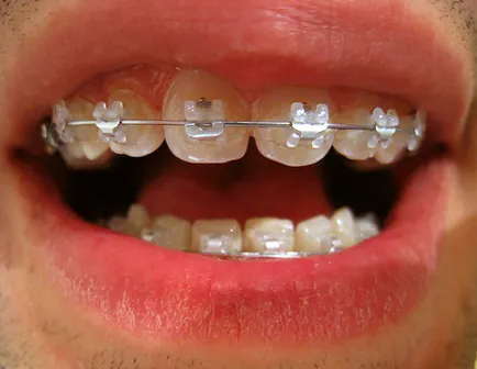 despre ortodonție