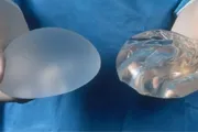 Complicații de sân din plastic ruptura implantului