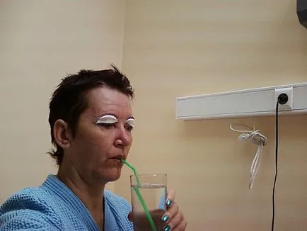 edem palpebral după tratamentul special blefaroplastia de edem și echimoze după blefaroplastie