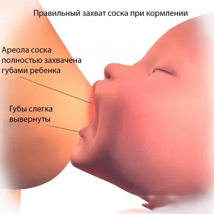 Miért fáj a melle, ha a baba etetés (szoptatás fáj) - okok és mit kell csinálni