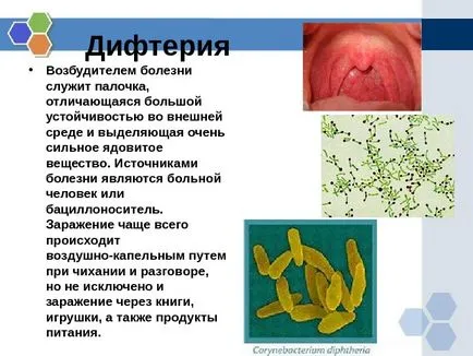 Prezentare Osnovnye infektsionnye zabolevaniya i Ikh profilaktika