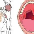 Gât Cancer cauze, simptome, diagnostic și tratament