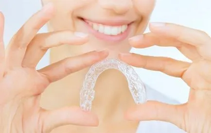 Прозрачни aligners за изправяне на зъбите прегледи на пациенти