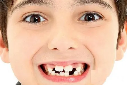 Erupția molarilor la copii