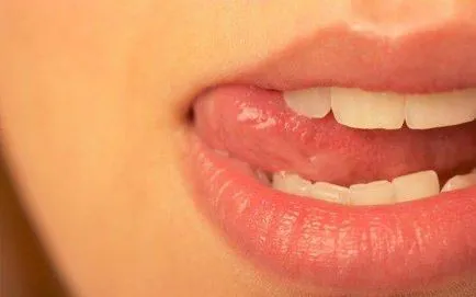 Дразнене в ъглите на устните причини и лечение на рани и пукнатини