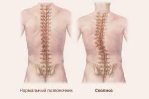 Рентгенови лъчи на гръбнака на гръдния кош както правят двете гледки, които показват подготовка