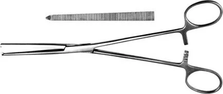 chondromatosis genunchi simptome articulare, tratament