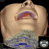 tomografia computer modern pentru stomatologie