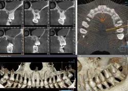 tomografia computer modern pentru stomatologie