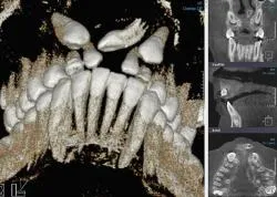 Модерна компютърна томография за стоматология