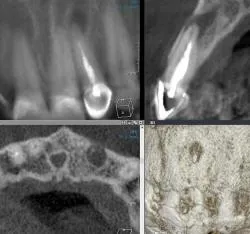 tomografia computer modern pentru stomatologie