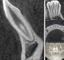 tomografia computer modern pentru stomatologie