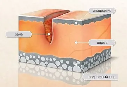 Remedy за белези по лицето