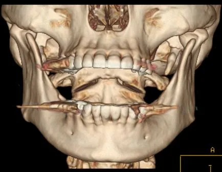 Модерна компютърна томография за стоматология
