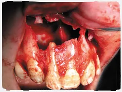 chirurgie orală, domenii de activitate