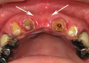 chirurgie orală, domenii de activitate