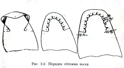 Szigorítása a bélés és a kemény orr